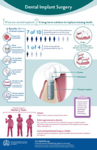 implant surgery